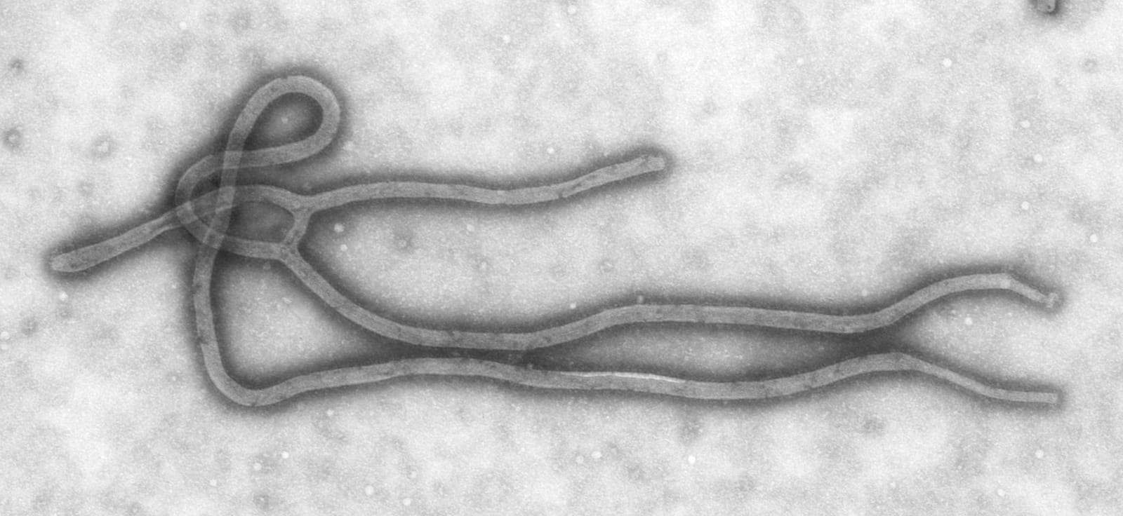 Transmission electron micrograph of an Ebola virus particle (file image; it shows Ebola virus, not the Bundibugyo virus in this outbreak, and is not from the event).