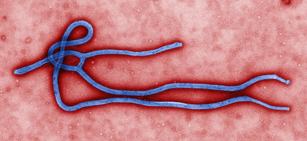A colourised transmission electron micrograph of an Ebola virus particle (file image, not specific to the current outbreak).