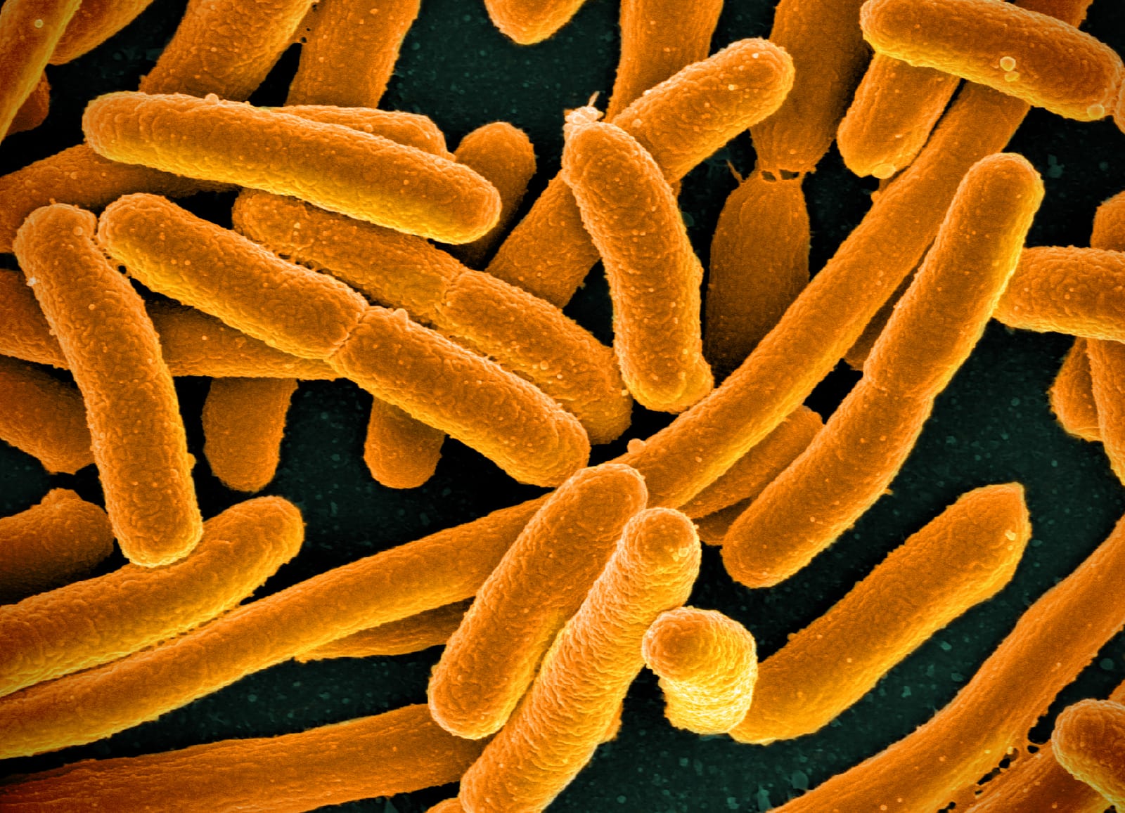 Colourised scanning electron micrograph of E. coli bacteria grown in culture (file image; not from the Nairobi study).